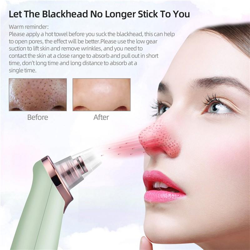 Máy hút mụn đầu đen CkeyiN MR278W