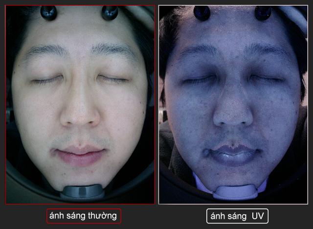 Máy phân tích da A-ONE Smart (PC Cam)