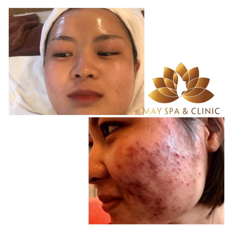 May Spa Clinic