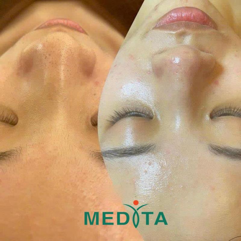 Medita Spa