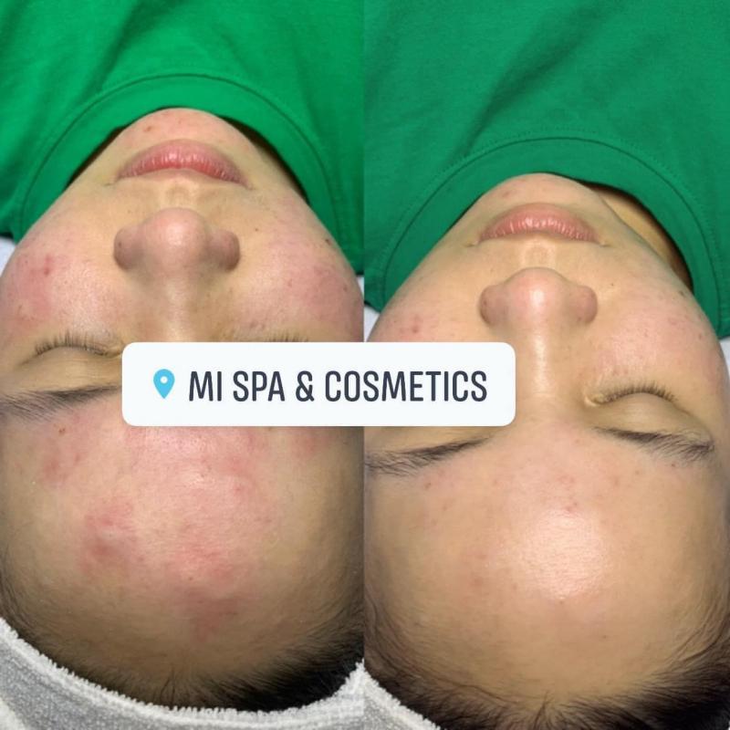 Mi Spa