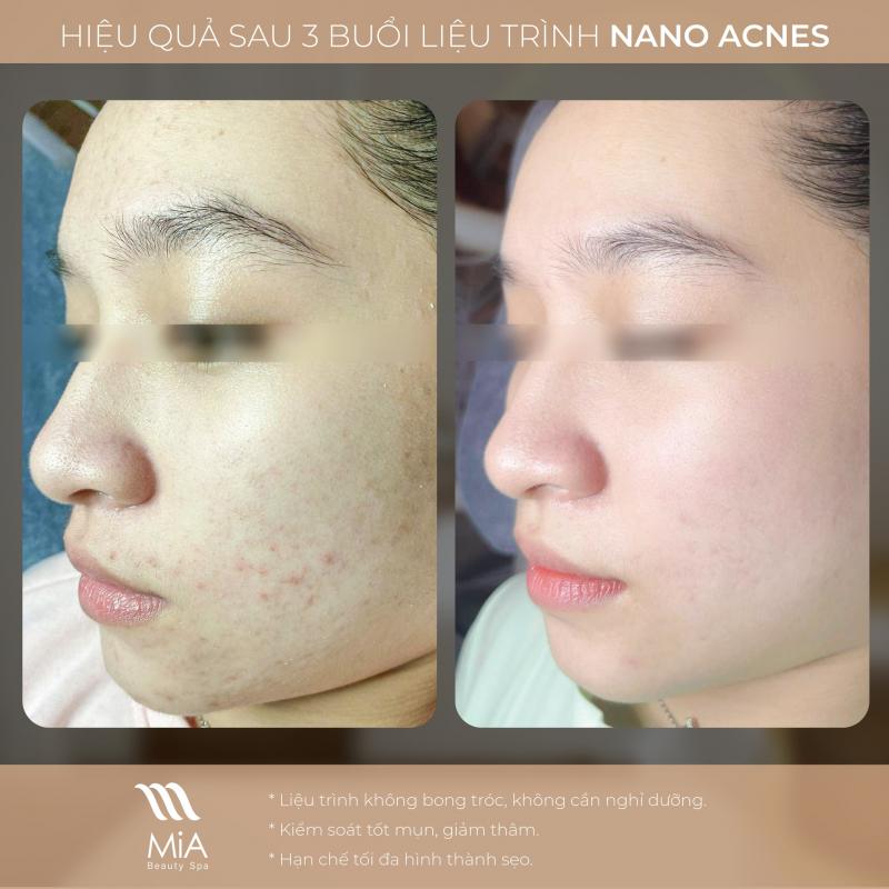 MiA Beauty Spa