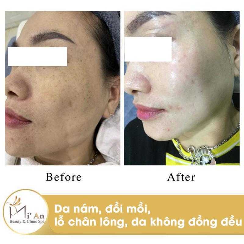 Mi'An Beauty & Clinic Spa