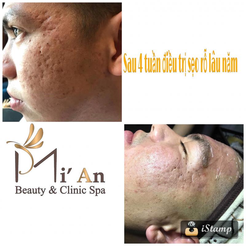 Mi'An Beauty & Clinic Spa