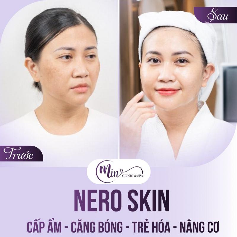 Mịn Clinic & Spa