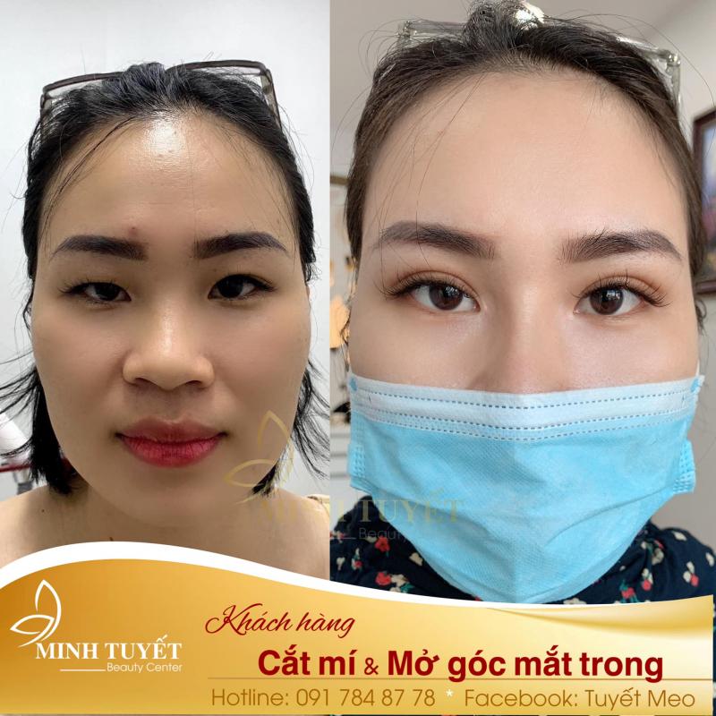 Thẩm Mỹ Viện Minh Tuyết Hà Tĩnh