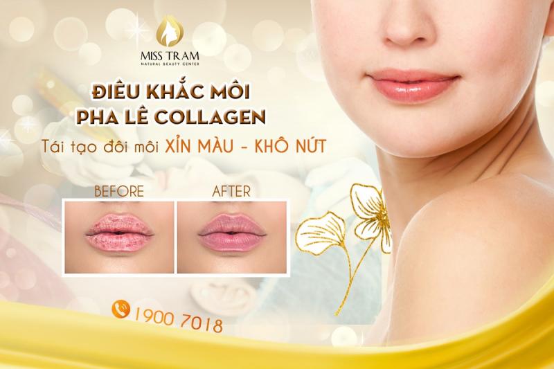 Miss Trâm Spa