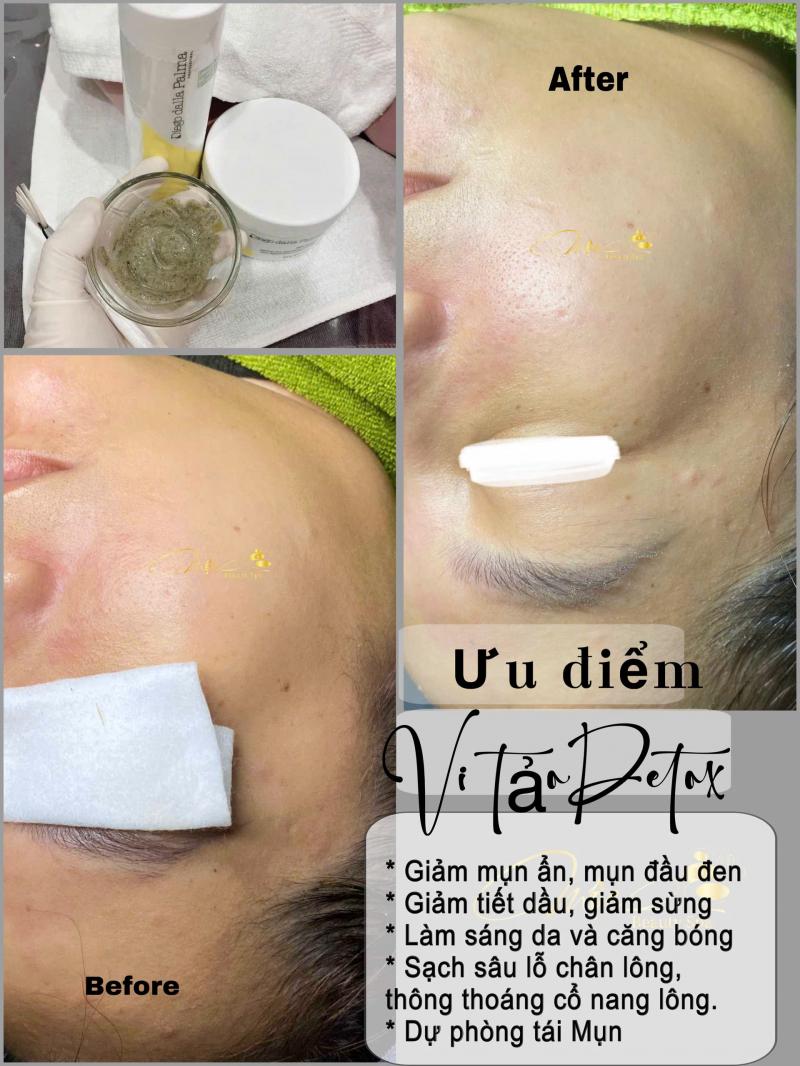 Mộc Beauty Spa