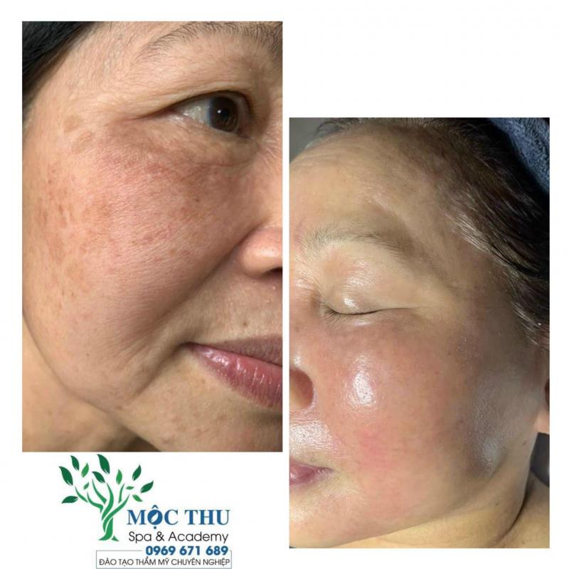Mộc Thu spa