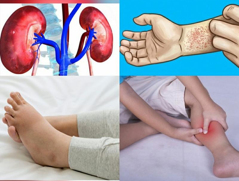 Những dấu hiệu cho biết thận của bạn đang có vấn đề