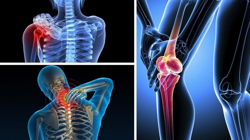 Hình ảnh minh họa về bệnh cơ xương khớp