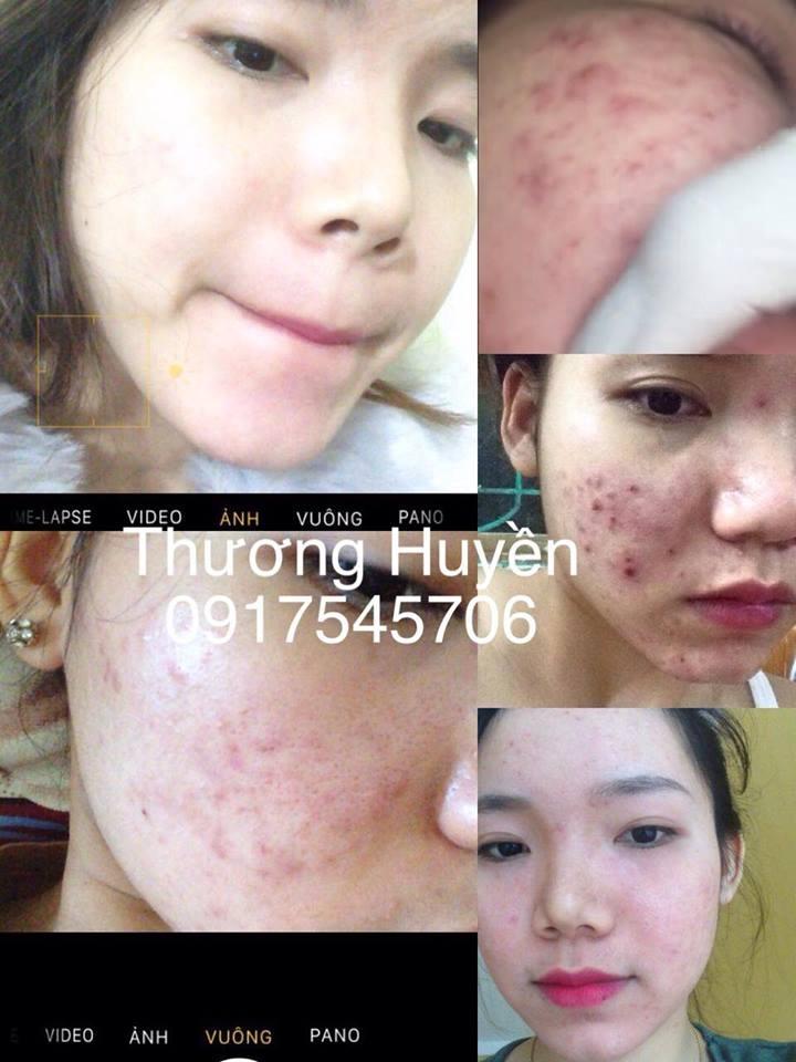 Một CTV phân phối sản phẩm đã từng tin dùng Diệp Phục Linh