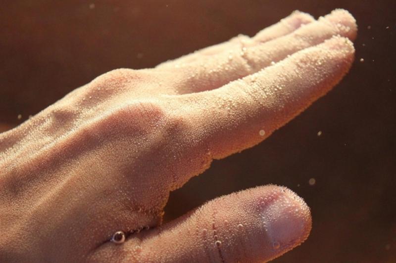 Các bọt khí acid cacbonic lăn tăn sủi bọt trên da