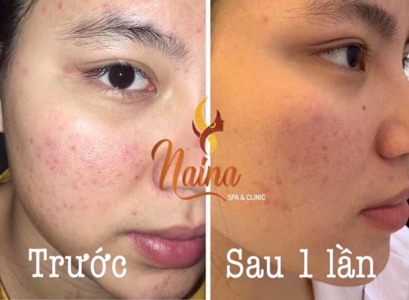 Naina Spa