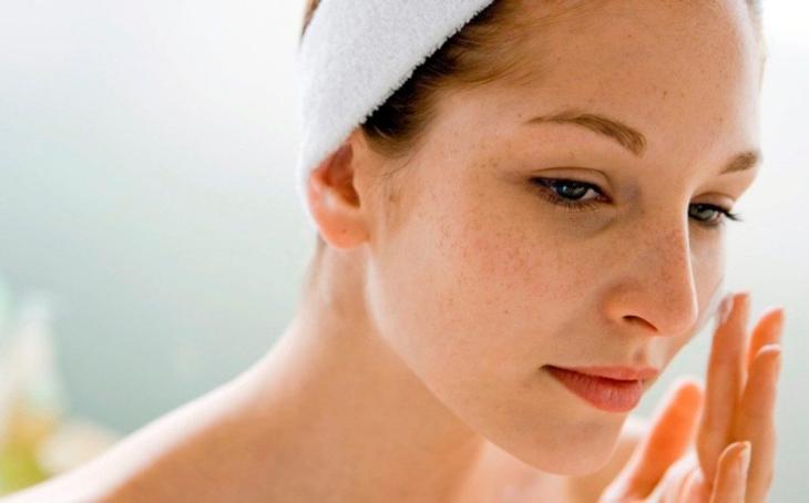 Nám da liên quan tới yếu tố di truyền