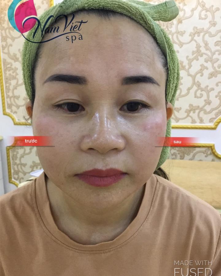 Nam Việt Spa