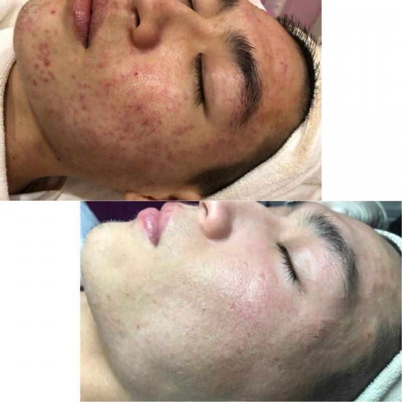 Nàng Spa.