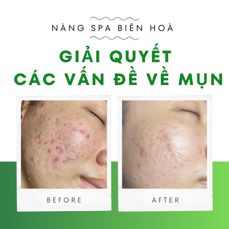 Nàng Spa Biên Hòa