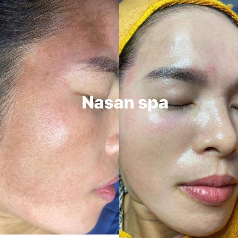 NaSan Spa Cần Giờ
