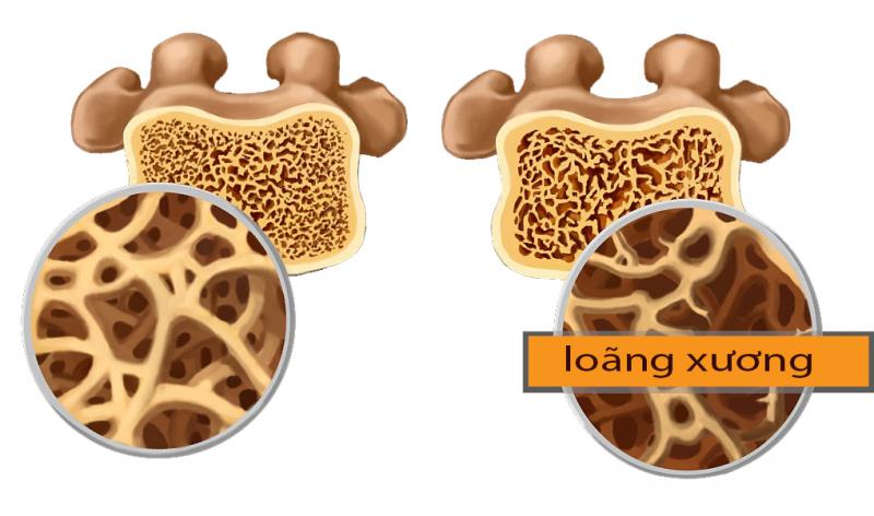 Tác hại của nước ngọt nếu bạn dùng không đúng cách
