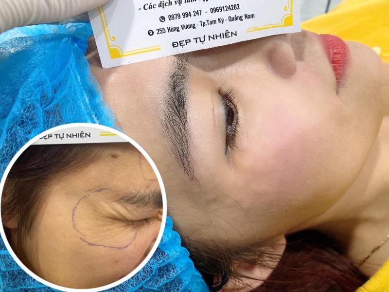Nguyễn Bằng - Thẩm Mỹ Công Ngệ Cao