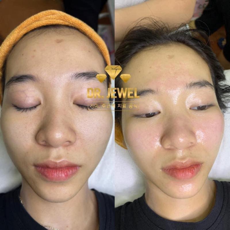 Nguyễn Beauty - Home Spa Biên Hoà