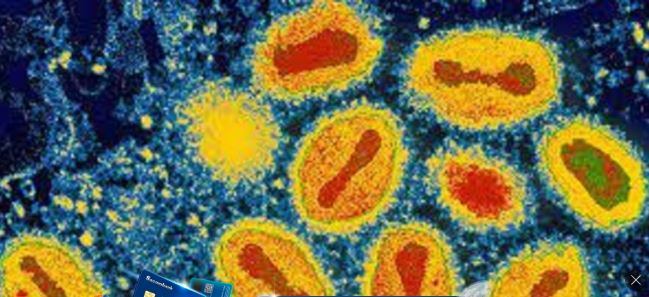 Virus đậu mùa