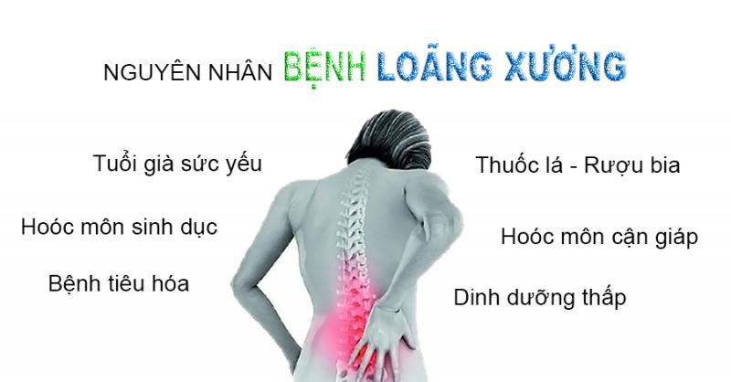 Nguyên nhân gây bệnh loãng xương