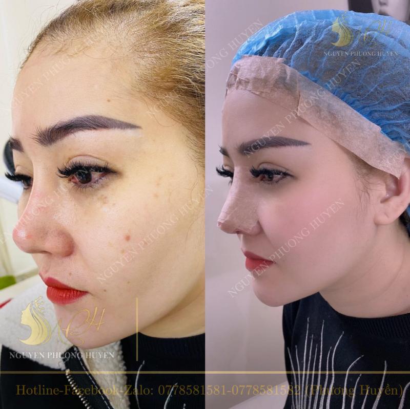 Nguyen Phuong Huyen Beauty Center