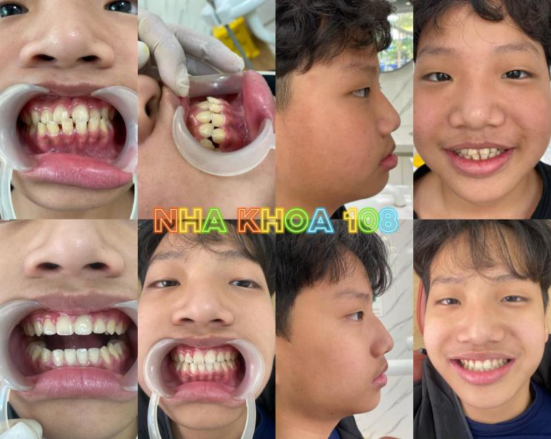 Nha khoa 108