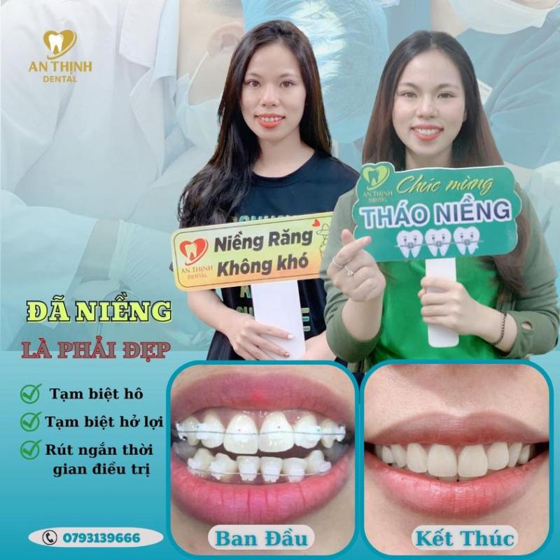 Nha Khoa An Thịnh