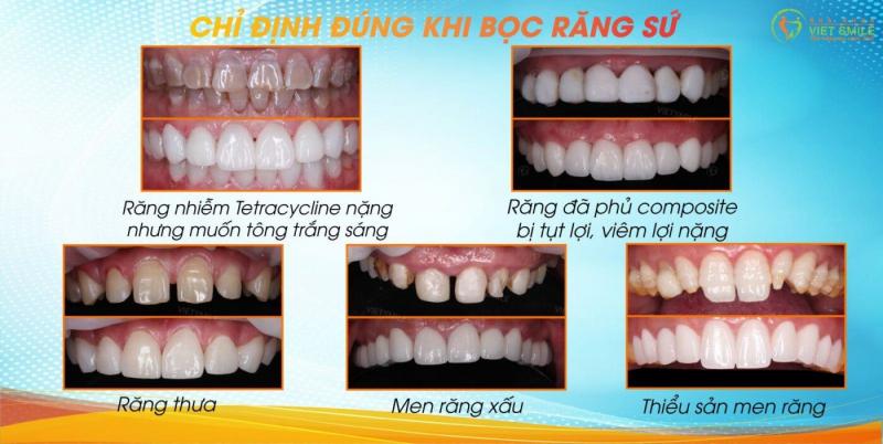 Nha Khoa Anh Dũng