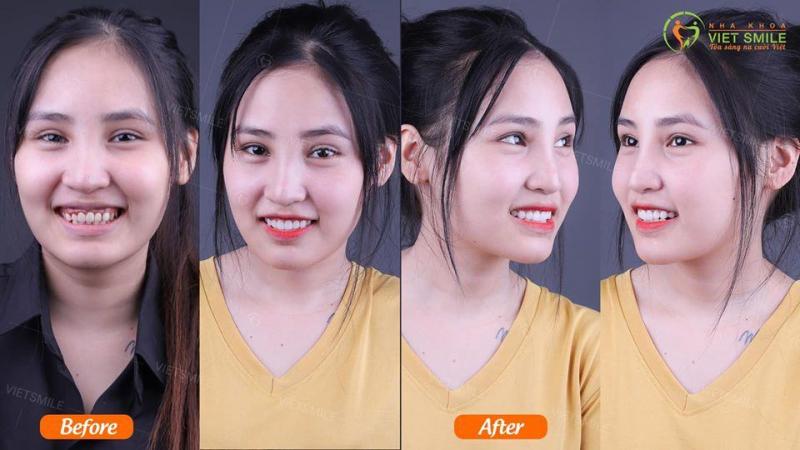 Nha Khoa Anh Dũng