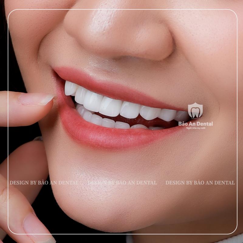Nha Khoa Bao An Dental