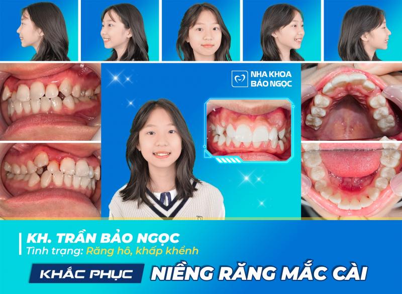 Nha khoa Bảo Ngọc