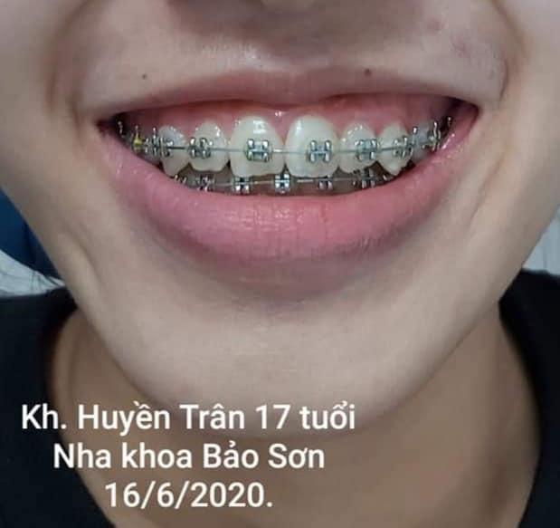 Nha khoa Bảo Sơn Kon Tum