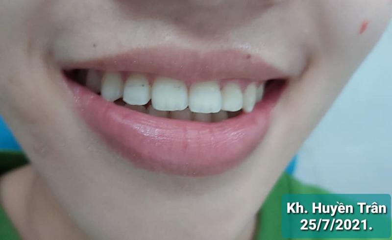 Nha khoa Bảo Sơn Kon Tum