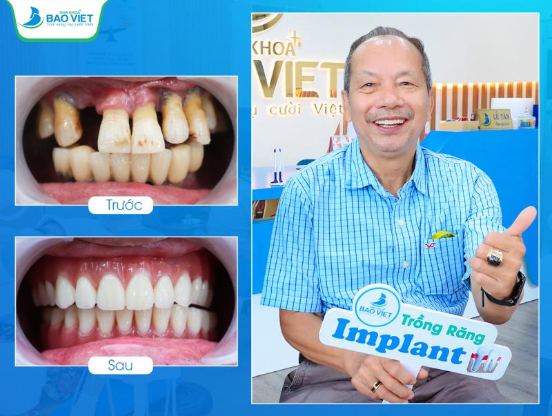 Nha Khoa Bảo Việt