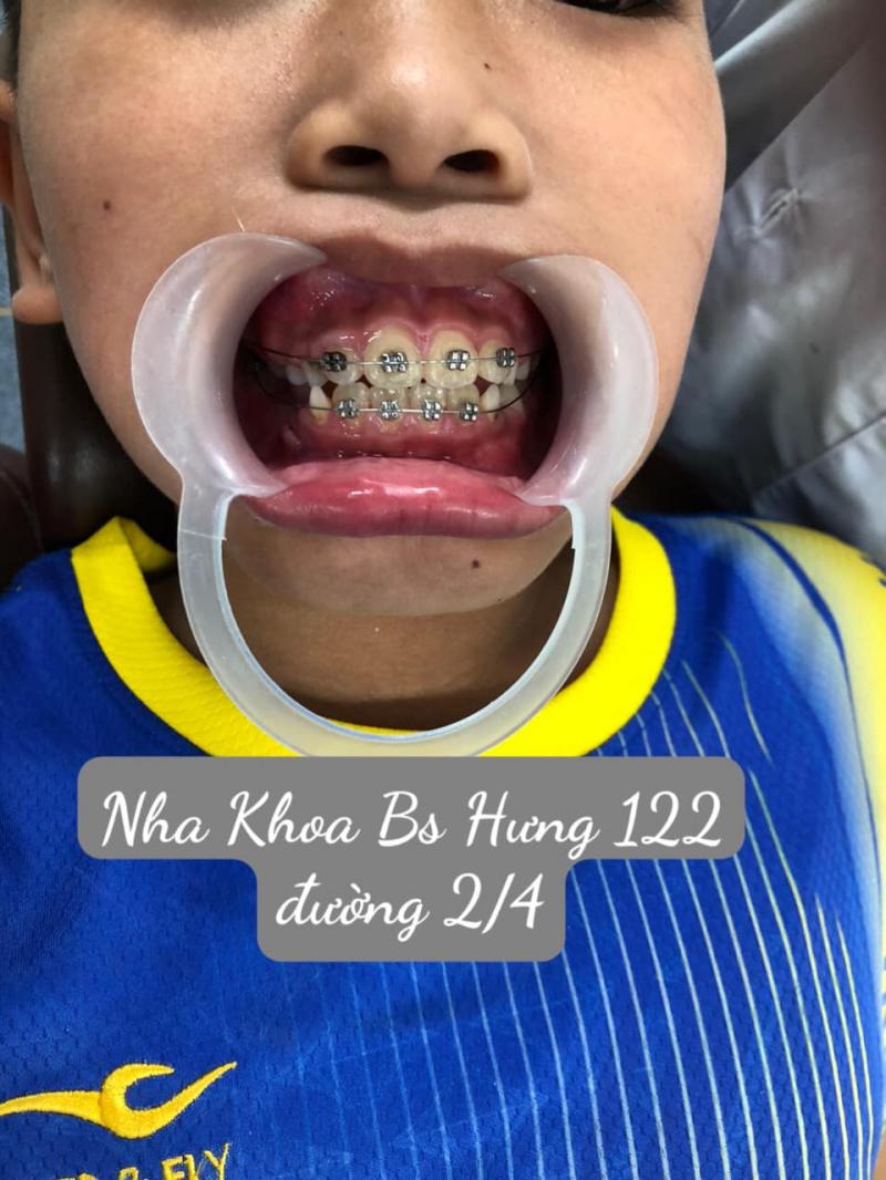 Nha Khoa BS Hưng
