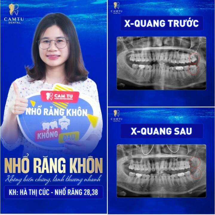 Nha Khoa Cẩm Tú - BS Hùng