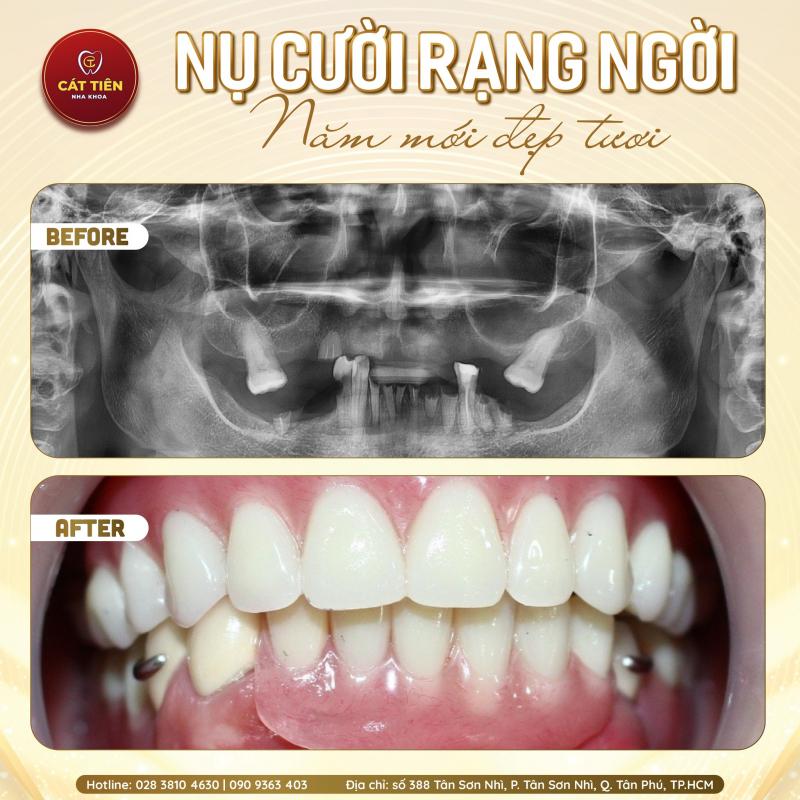 Nha khoa Cát Tiên