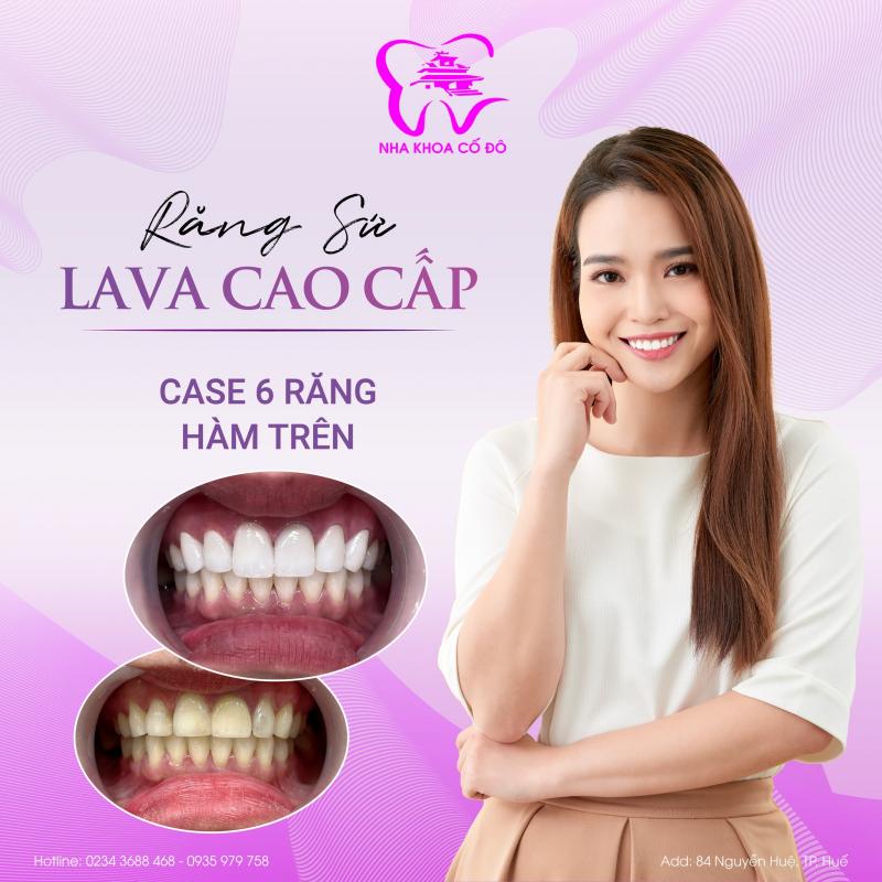 Nha Khoa Cố Đô