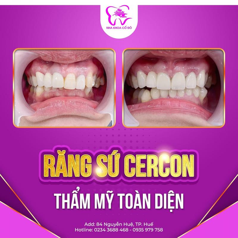 Nha Khoa Cố Đô