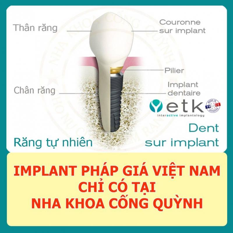 Nha Khoa Cống Quỳnh