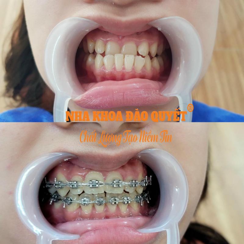 Nha Khoa Đào Quyết