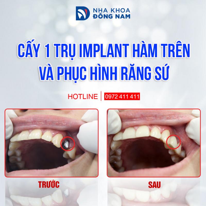 Nha khoa Đông Nam