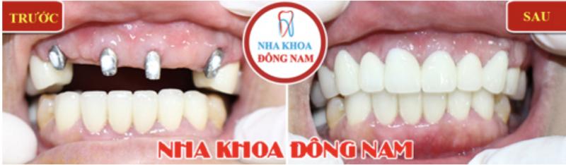 Nha Khoa Đông Nam