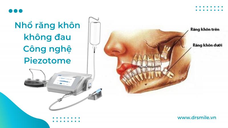 Nha khoa Dr.Smile