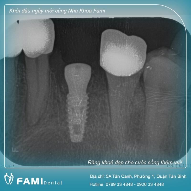 Nha Khoa Fami Dental