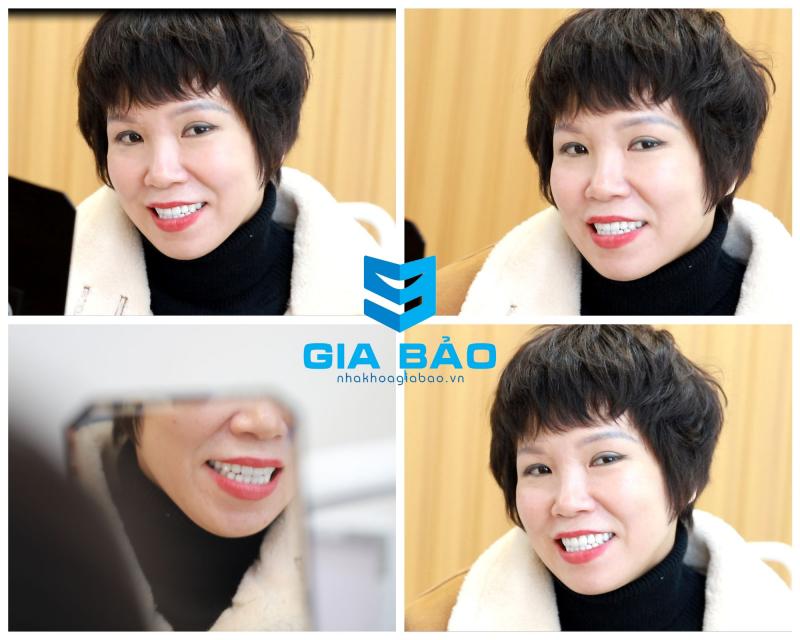 Nha khoa Gia Bảo Hải Phòng